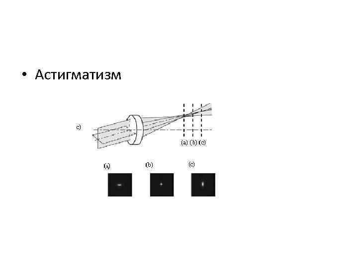  • Астигматизм 