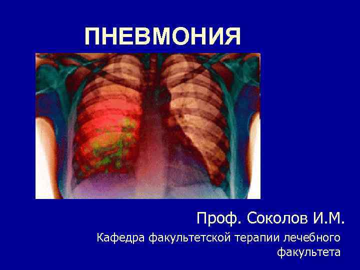 Факультетская терапия. Пневмония Факультетская терапия. Пневмония терапия Факультетская лекция. Воспаление легких презентация 8 класс. Пневмония тема по Факультетская терапия.