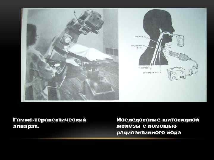 Гамма-терапевтический аппарат. Исследование щитовидной железы с помощью радиоактивного йода 