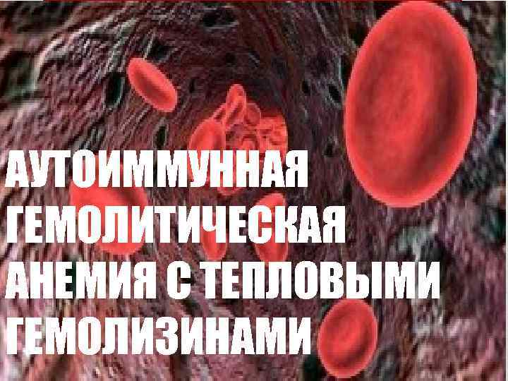 АУТОИММУННАЯ ГЕМОЛИТИЧЕСКАЯ АНЕМИЯ С ТЕПЛОВЫМИ ГЕМОЛИЗИНАМИ 