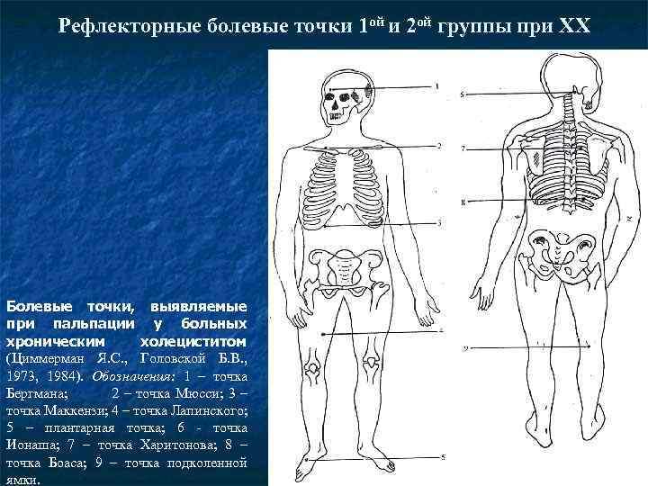 Рефлекторные болевые точки 1 ой и 2 ой группы при ХХ Болевые точки, выявляемые