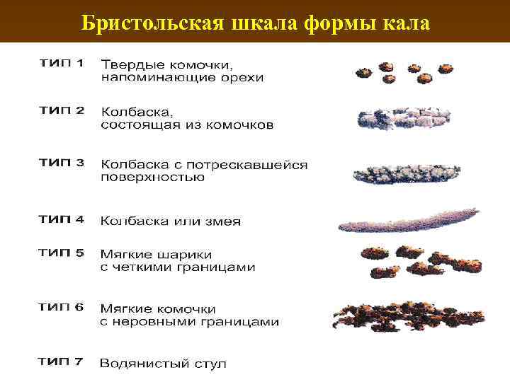 Бристольская шкала формы кала 