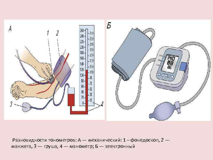  Разновидности тонометров: А — механический: 1 – фонедоскоп, 2 — манжета, 3 —