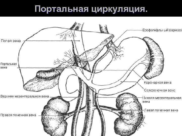 Портальная гипертензия мкб. Портальная циркуляция. Портальная гипертензия из за селезёнки. Портальная зона.