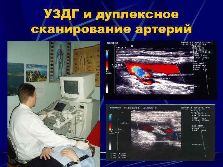 Дуплексное сканирование сосудов почек