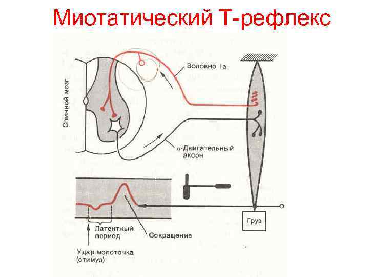 Миотатический Т-рефлекс 