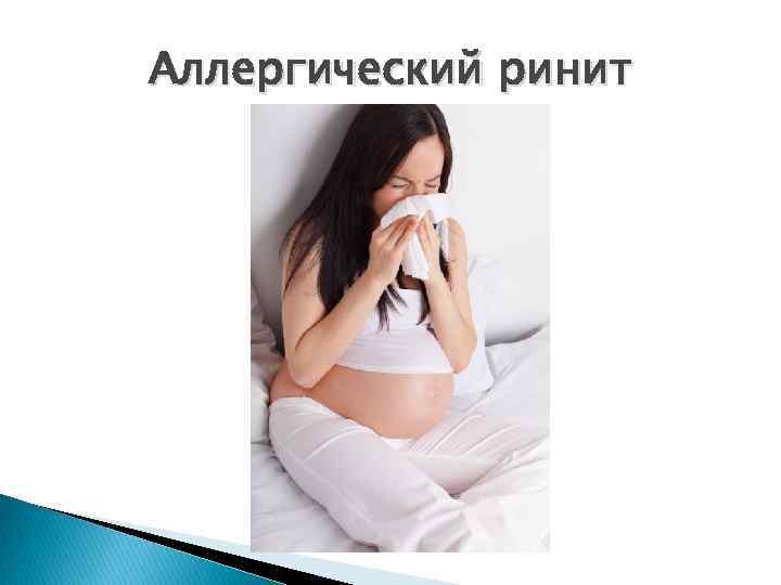 Аллергический ринит 