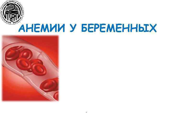 АНЕМИИ У БЕРЕМЕННЫХ . 