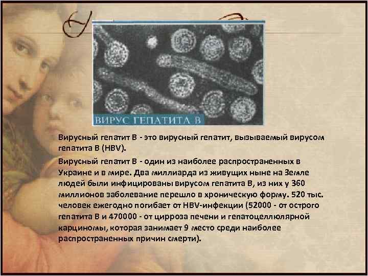 Вирусный гепатит В - это вирусный гепатит, вызываемый вирусом гепатита В (HВV). Вирусный гепатит