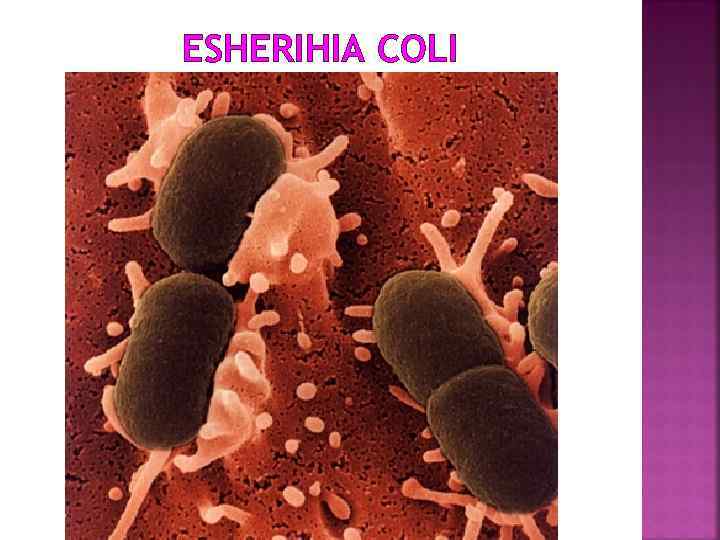 ESHERIHIA COLI 