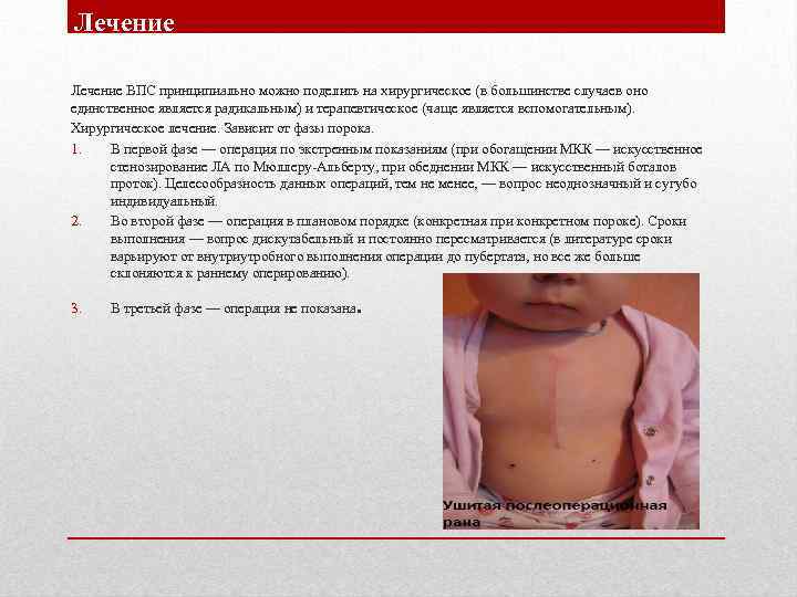 Лечение ВПС принципиально можно поделить на хирургическое (в большинстве случаев оно единственное является радикальным)