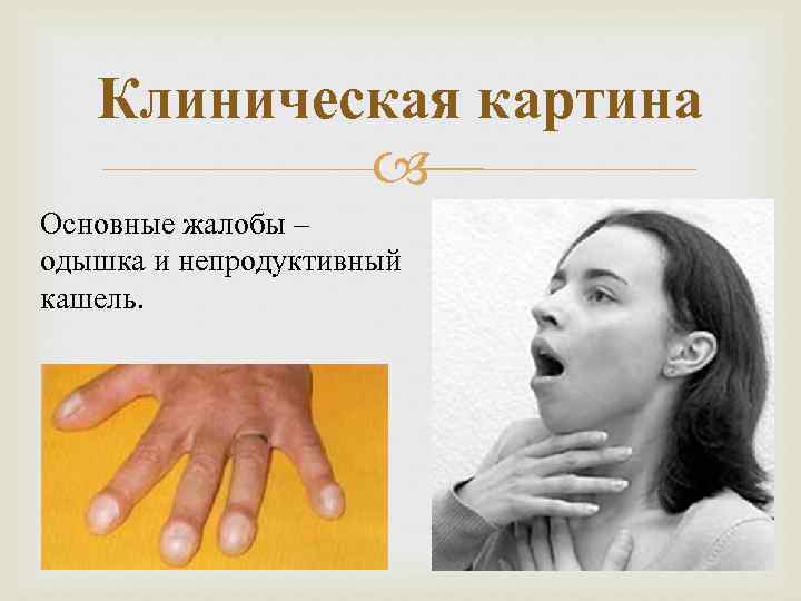 Клиническая картина Основные жалобы – одышка и непродуктивный кашель. 