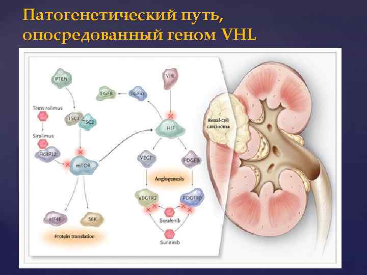 Патогенетический путь, опосредованный геном VHL 