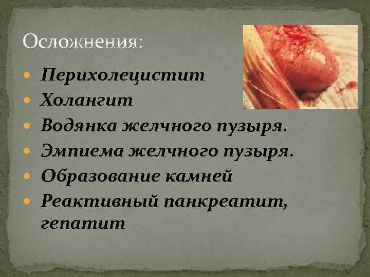 Осложнения: Перихолецистит Холангит Водянка желчного пузыря. Эмпиема желчного пузыря. Образование камней Реактивный панкреатит, гепатит