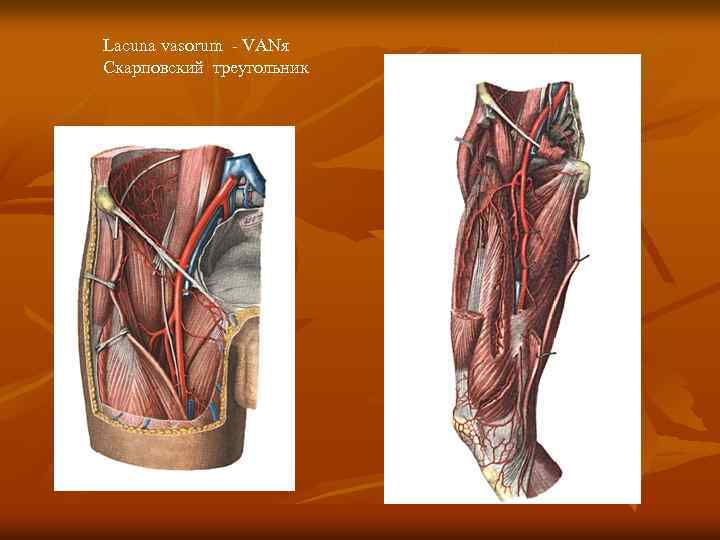 Lacuna vasorum - VANя Скарповский треугольник 