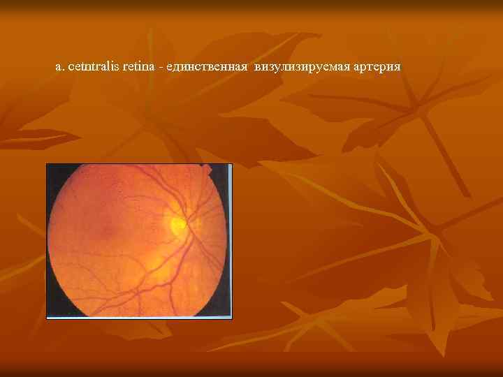 a. cetntralis retina - eдинственная визулизируемая артерия 