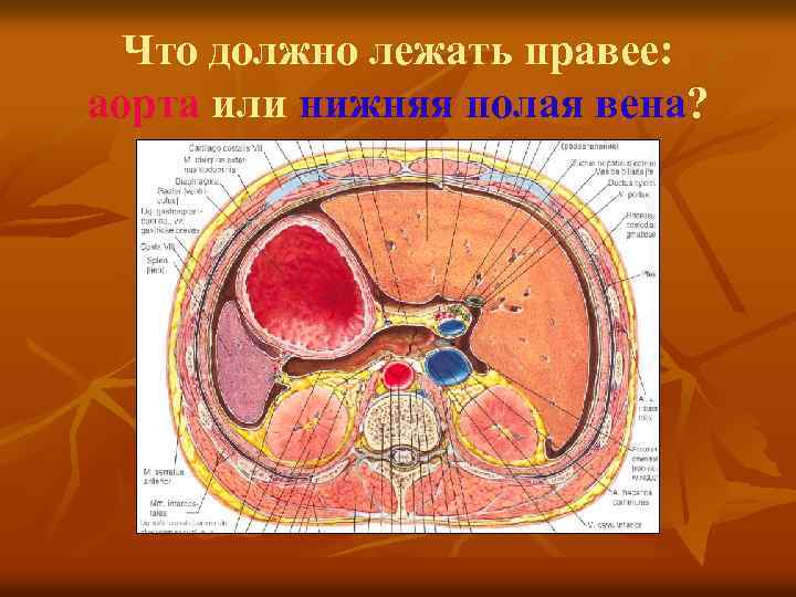 Что должно лежать правее: аорта или нижняя полая вена? 