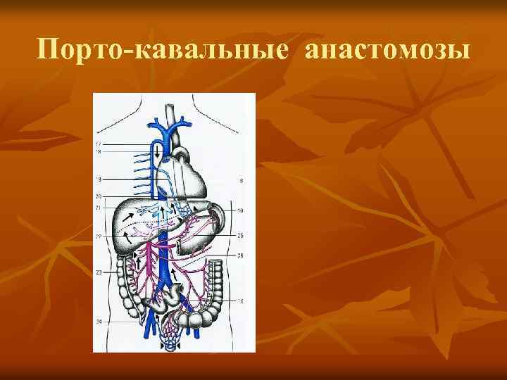 Порто-кавальные анастомозы 