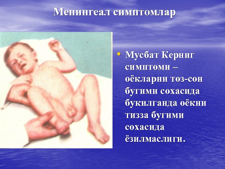 Менингеал симптомлар • Мусбат Керниг симптоми – оёкларни тоз-сон бугими сохасида букилганда оёкни тизза