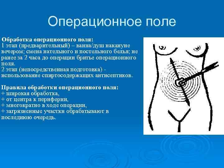 Операционное поле Обработка операционного поля: 1 этап (предварительный) – ванна/душ накануне вечером; смена нательного