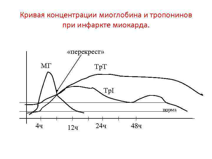 Кривая концентрации миоглобина и тропонинов при инфаркте миокарда. «перекрест» МГ Тр. Т Тр. I