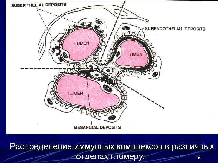 Распределение иммунных комплексов в различных 9 отделах гломерул 