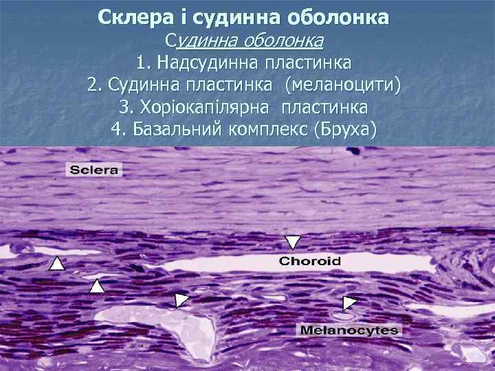 Склера і судинна оболонка Судинна оболонка 1. Надсудинна пластинка 2. Судинна пластинка (меланоцити) 3.