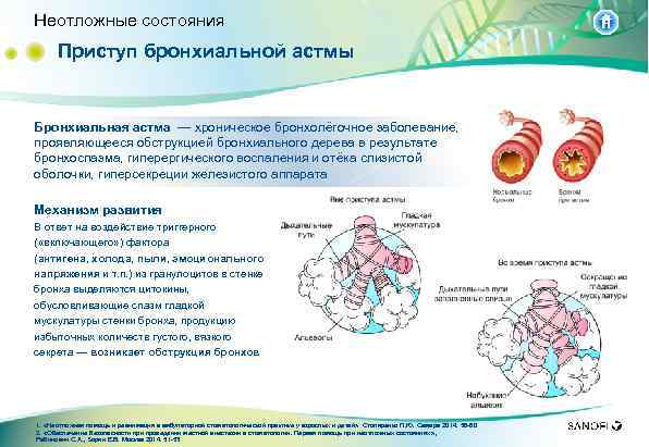 Неотложные состояния Приступ бронхиальной астмы Бронхиальная астма — хроническое бронхолёгочное заболевание, проявляющееся обструкцией бронхиального