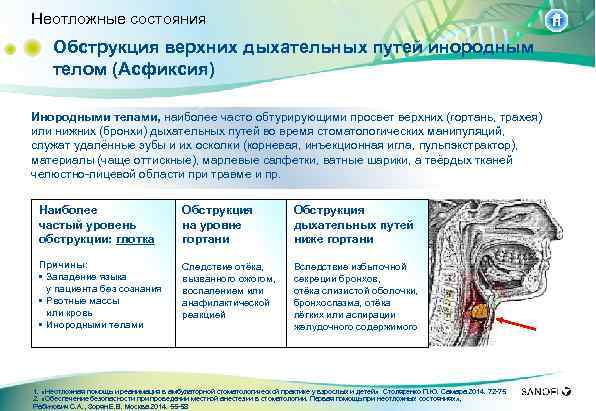 Признаки обструкции дыхательных путей схема полная и частичная