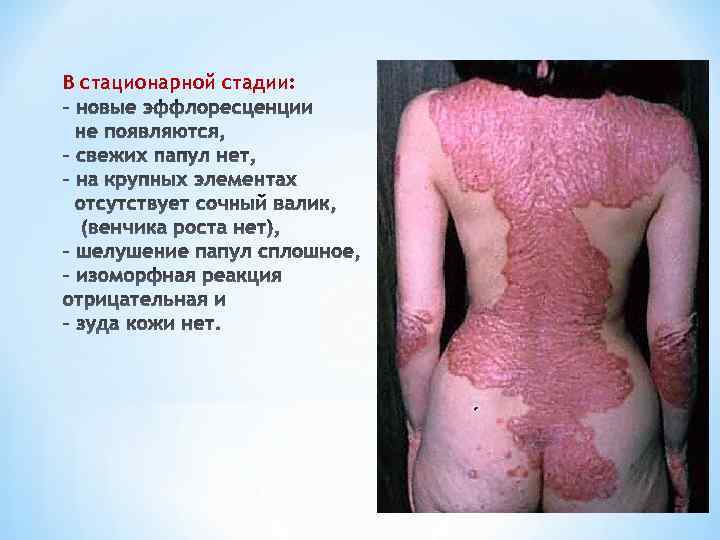 В стационарной стадии: 