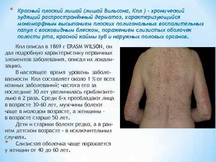 * Красный плоский лишай (лишай Вильсона, Кпл ) - хронический зудящий распространённый дерматоз, характеризующийся