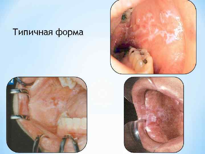 Типичная форма 