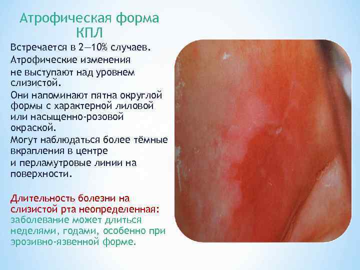 Атрофическая форма КПЛ Встречается в 2— 10% случаев. Атрофические изменения не выступают над уровнем