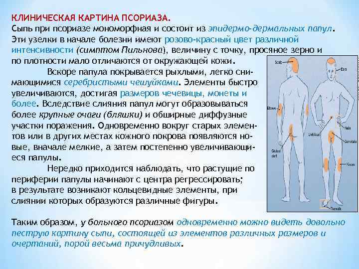 Полиморфная клиническая картина это