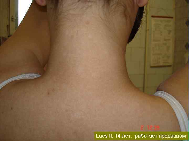 Lues II, 14 лет, работает продавцом 