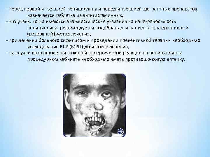  перед первой инъекцией пенициллина и перед инъекцией дю рантных препаратов назначается таблетка из