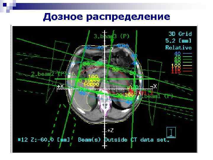 Лучевое 1 карта