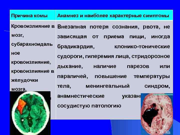Причина комы Анамнез и наиболее характерные симптомы Кровоизлияние в Внезапная потеря сознания, рвота, не