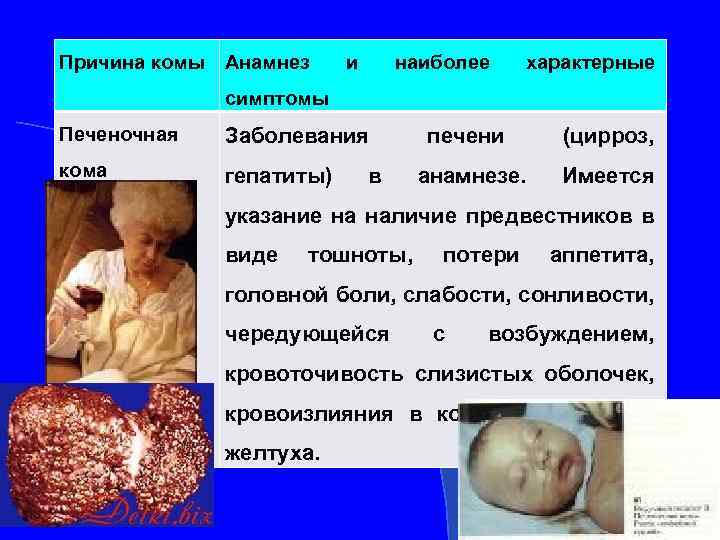 Причина комы Анамнез и наиболее характерные симптомы Печеночная Заболевания кома гепатиты) в печени (цирроз,
