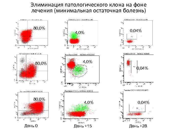 Элиминация патологического клона на фоне лечения (минимальная остаточная болезнь) 80, 0% 4, 0% 0,