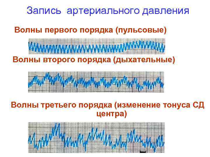 Давление волны. Волны 1 2 3 порядка на Кривой артериального давления. Волны 3 порядка на Кривой кровяного давления. Волны артериального давления 1-го, 2-го, 3-го порядка, их происхождение.. Регулярные колебания артериального давления крови.