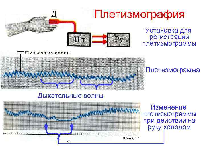 Плетизмография Установка для регистрации плетизмограммы Плетизмограмма Дыхательные волны Изменение плетизмограммы при действии на руку