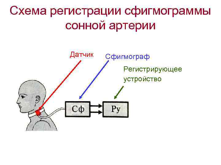 Схема регистрации сфигмограммы сонной артерии Датчик Сфигмограф Регистрирующее устройство 