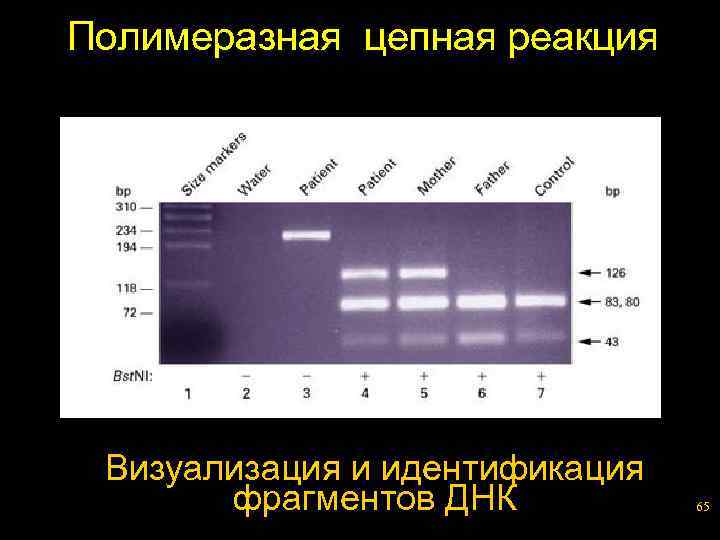 Полимеразная цепная реакция Визуализация и идентификация фрагментов ДНК 65 