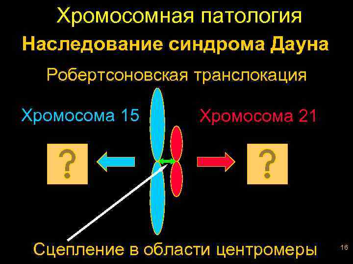 Хромосомная патология Наследование синдрома Дауна Робертсоновская транслокация Хромосома 15 Хромосома 21 Сцепление в области