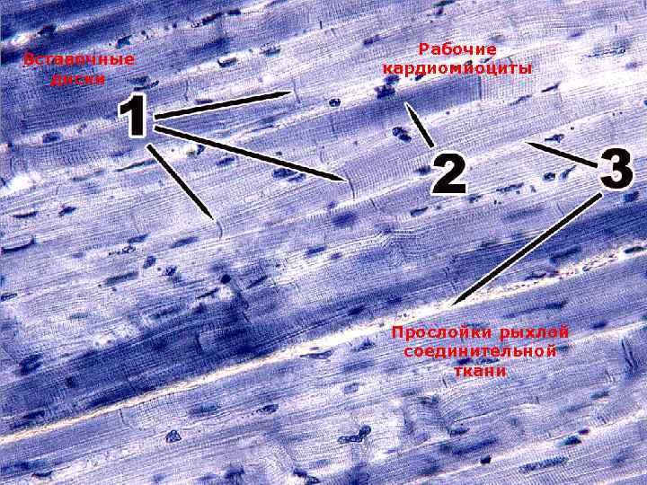 Вставочные диски Рабочие кардиомиоциты Прослойки рыхлой соединительной ткани 