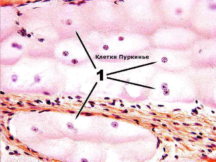Клетки пуркинье рисунок