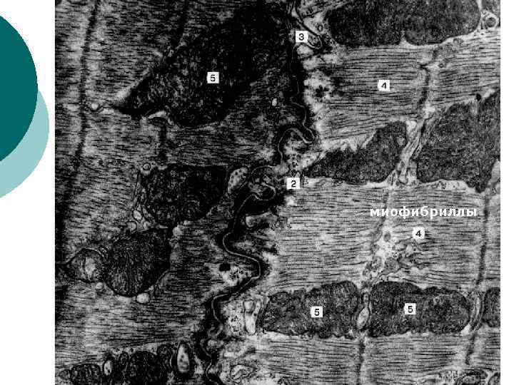 миофибриллы 