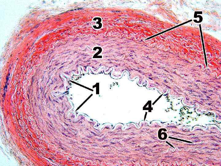 Рисунок артерии мышечного типа