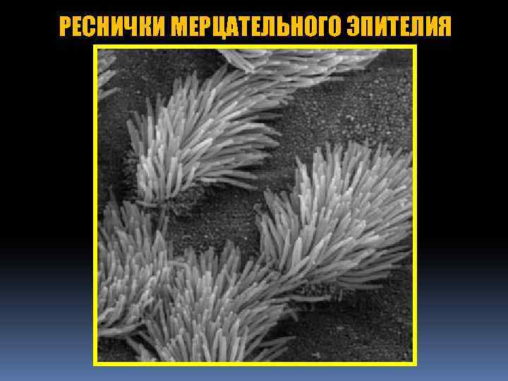 РЕСНИЧКИ МЕРЦАТЕЛЬНОГО ЭПИТЕЛИЯ 